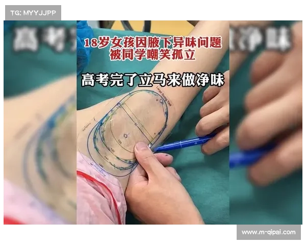 拳台医生王磊:10年处理200例创伤,最怕耳廓血肿畸形 拳台医生王磊:10年处理200例创伤,最怕耳廓血肿畸形